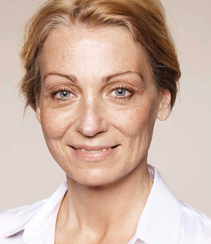revitalizacionfacial_big10 revitalizacionfacial_big10